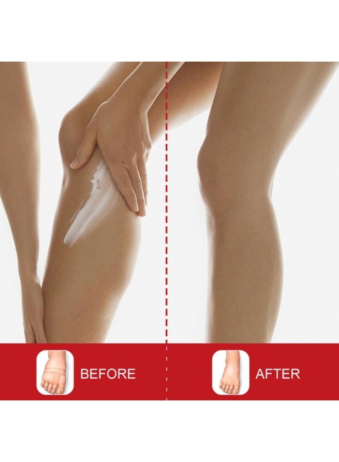 Sumifun Leg Edema Relief Cream - Anti-Swelling Massage Cream for Swollen Legs, Ankles & Feet - Fast-Absorbing, 20g - Image 5