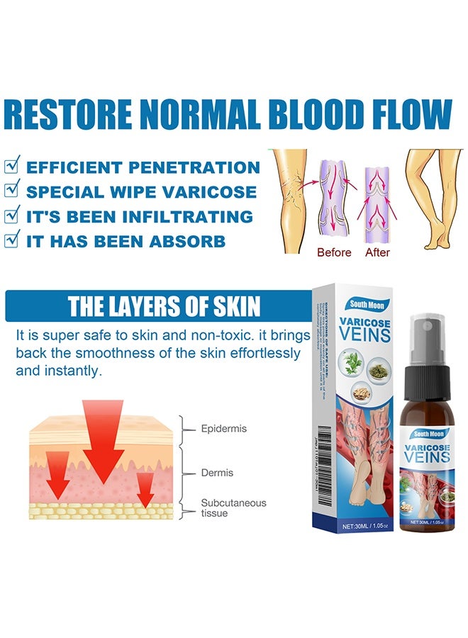 ساوث مون بخاخ تسكين الأوردة 30 مل، بخاخ علاج عضلة قدم الأوردة، يخفف من تعب الساق - Image 3