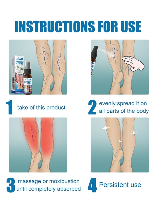 ساوث مون بخاخ تسكين الأوردة 30 مل، بخاخ علاج عضلة قدم الأوردة، يخفف من تعب الساق - Image 5