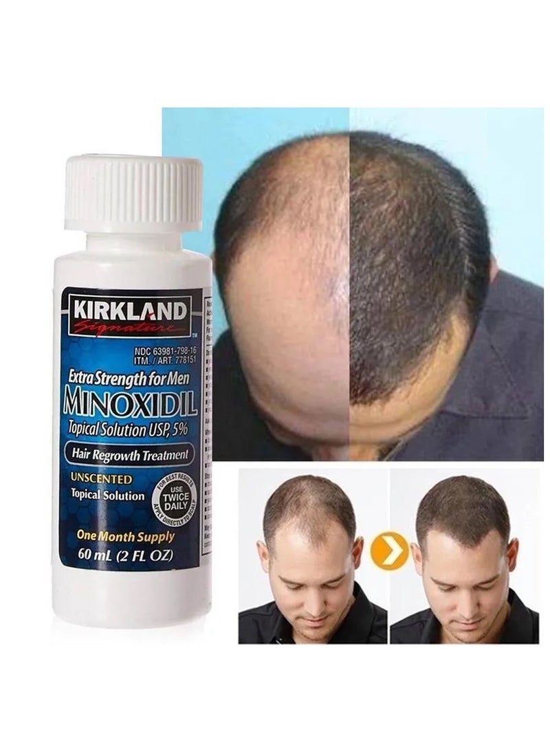 Kirkland Signature - Minoxidil 5% Hair & Beard Topical Solution Hair Regrowth Treatment 1 Month Supply - Image 1