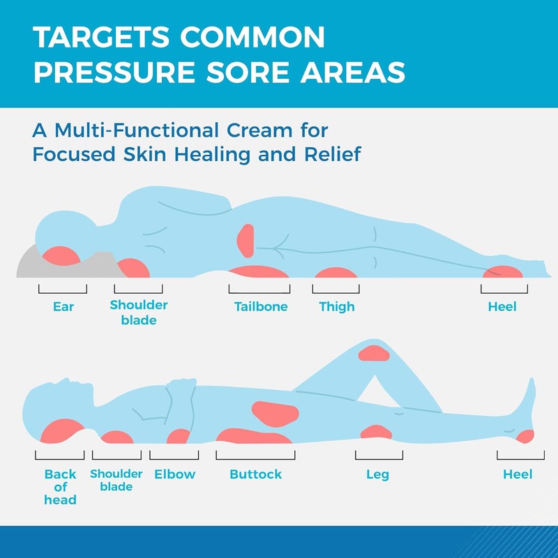 Roycederm Bed and Pressure Sore Treatment Cream Fast Healing Cream for Chafed Skin and Pressure Ulcers on Legs Buttocks Pressure Sore Relief for Bedridden Elderly and Amputees with Calendula 35OZ - Image 4