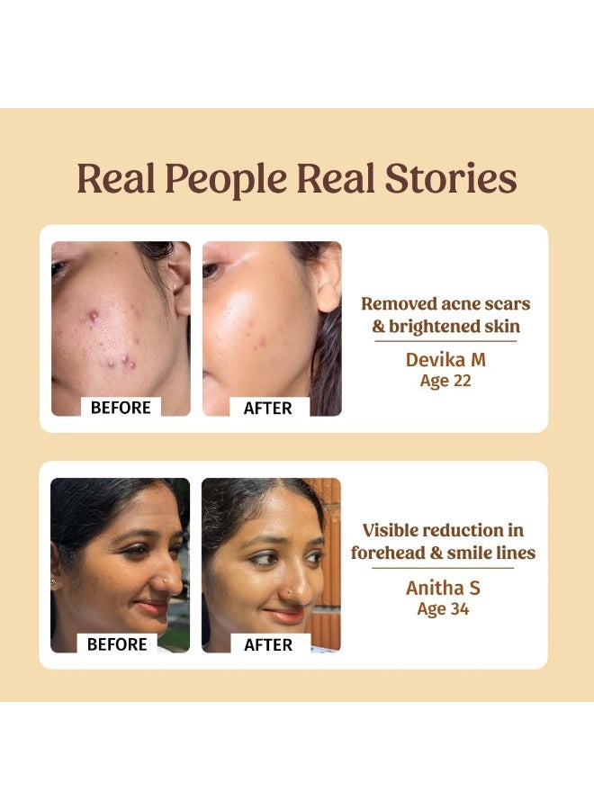 Vilvah Store AM PM Face Serum Combo | Milk Drops Serum and Better Ageing Serum | Skin Brightening, Even Skin Tone, Anti-Ageing, Wrinkle Repair | Rice Milk Extract and Blue Pea Flower | 20ml + 20ml - Image 3