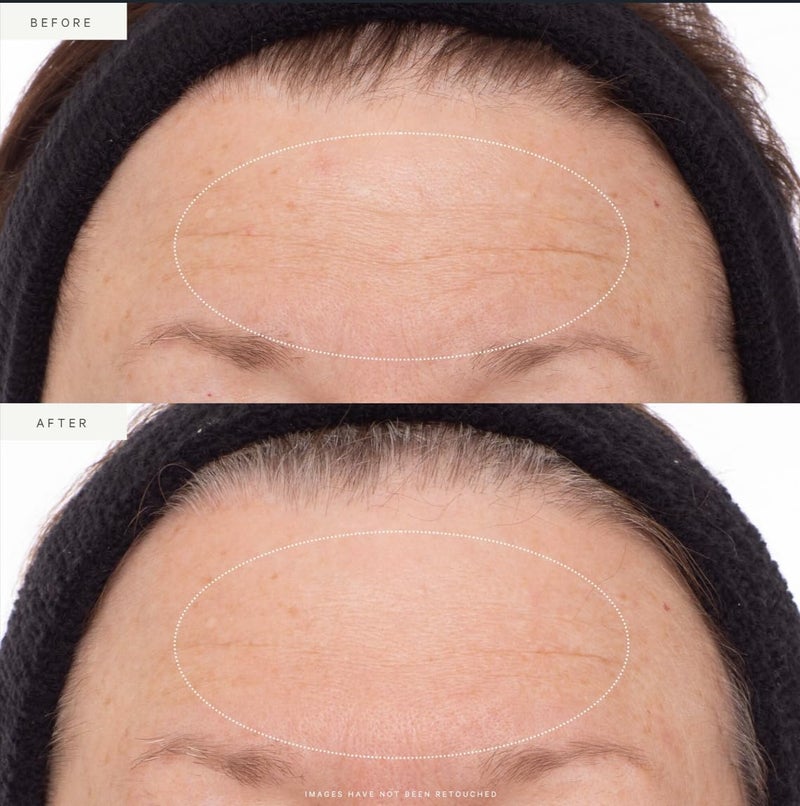 KORA Organics Plant Stem Cell Retinol Alternative Serum, Firming Face Serum, Repair Signs of Aging, Promotes Radiant Skin, Certified Organic, Cruelty Free - Smoothening Retinol for Face - 1.01 fl oz - Image 3