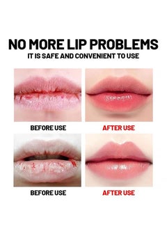 HEALMUSZ Lip Repair Gel for Repairing and Protecting Chapped and Dry Lips | Cold Compress Safe Lip Balm | Instant Cooling and Pain Relief | Dead Skin Removal/Fade Lip Lines/Improve Lip Color/Repair Cheilitis  - Image 2