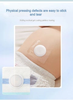 Gasin 5PCS Medical Hernia Convex Sticker Belly Baby Umbilical Hernia Sticker  - Image 3