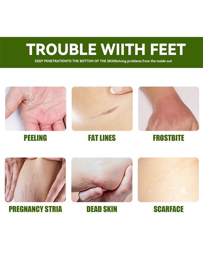 هيرباسين 2 قطعة كريم اليدين كاميل مع الجلسرين 75 مل ، ينعم البشرة ويرطب ويحافظ على مرونة البشرة من السيليكون ، ويوفر الرطوبة والحماية للبشرة المتشققة الخشنة - Image 4