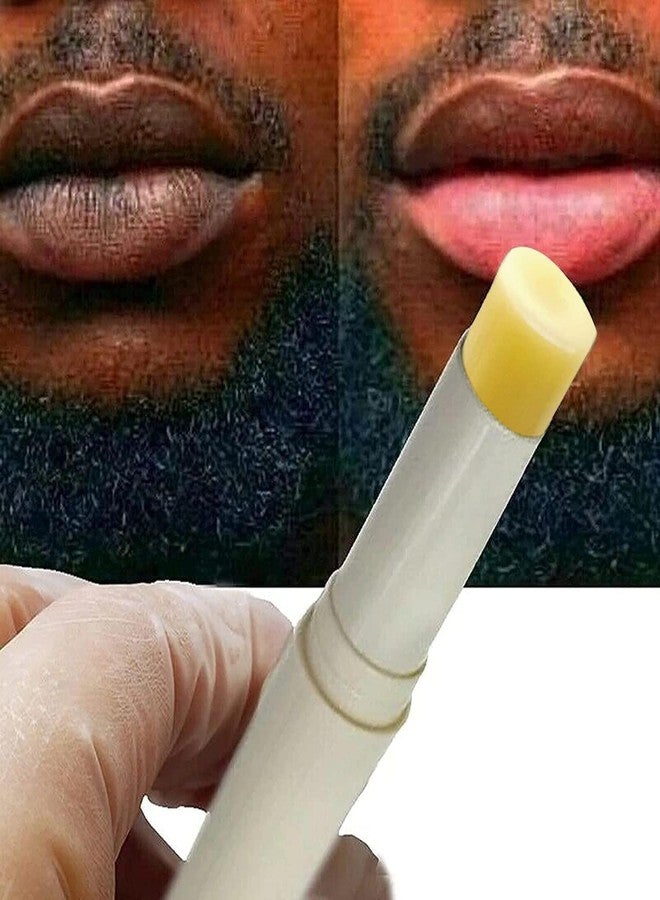 MSECVOI 2PCS Lip Lightening for Dark Lips Lip for Smokers Dark Lip Treatment Lightening Cream for Pink Lips Lip Lightener for Smoker Lips Lip Lightening balm for Men and Women (Yellow) - Image 1