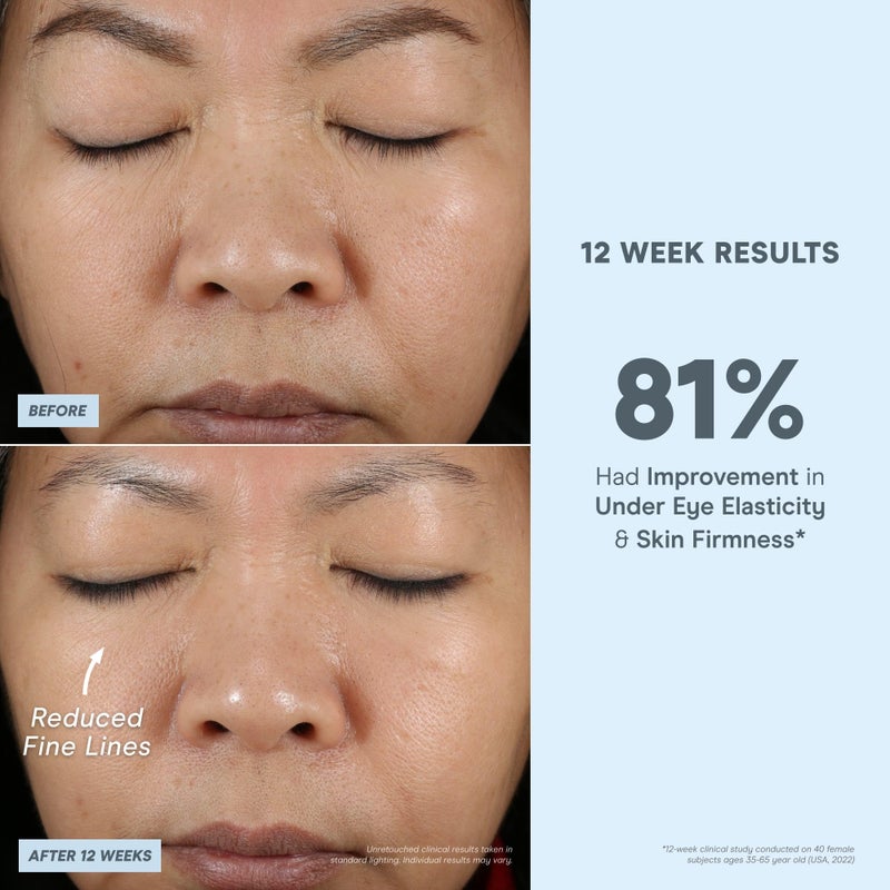 NuFACE Vita-C Brightening Face Serum - Vitamin C Serum for Dark Spots & Even Skin Tone + Niacinamide for Soothing Redness - Boosts Results of Microcurrent Treatments, Daily Skin Care (1oz) - Image 5