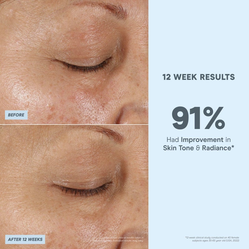 NuFACE Vita-C Brightening Face Serum - Vitamin C Serum for Dark Spots & Even Skin Tone + Niacinamide for Soothing Redness - Boosts Results of Microcurrent Treatments, Daily Skin Care (1oz) - Image 3