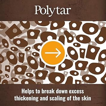 Polytar Scalp Shampoo For Scalp Conditions Reduces Itching Inflammation and Scales Shampoo Treats Psoriasis Seborrhoeic Dermatitis Eczema and Dandruff Contains Coal Tar Solution 1 x 150ml - Image 5