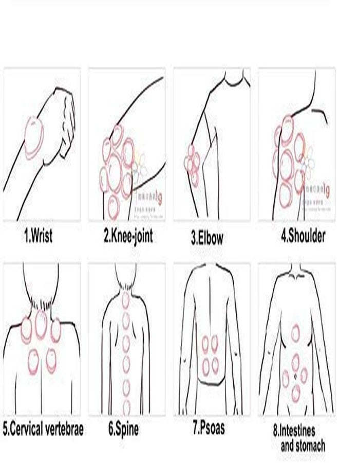 ANCS Hijjama Vacumm Cupping Set 6 Cups, Hijjama, cupping therapy cups set - Image 5