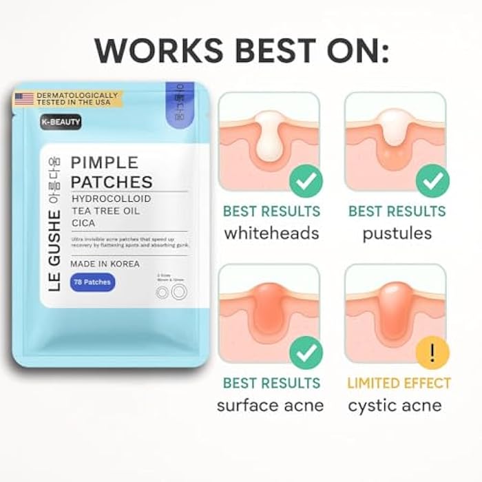 LE GUSHE Korean Pimple Patches for Face (78 Dots) - Hydrocolloid Acne Patches with Tea Tree Oil - Invisible Zit Stickers - Dermatologist Tested - Korean Skin Care - Image 5