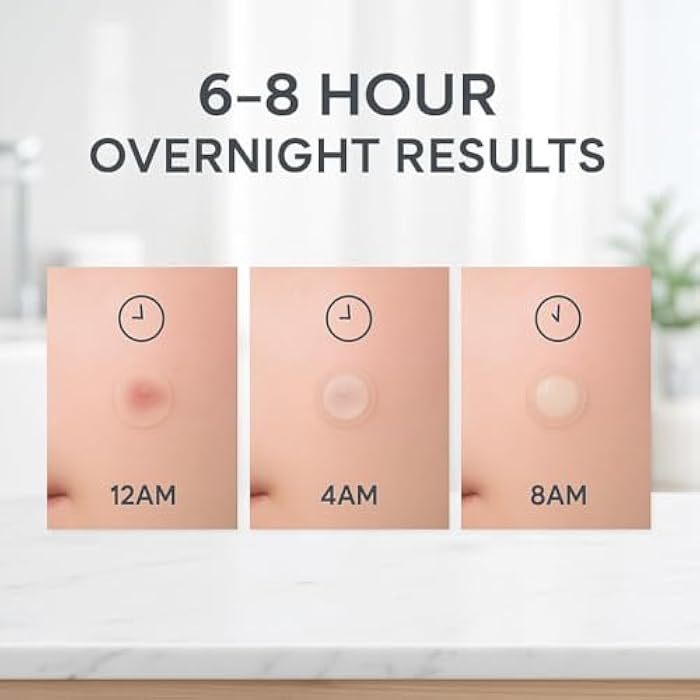 LE GUSHE Korean Pimple Patches for Face (78 Dots) - Hydrocolloid Acne Patches with Tea Tree Oil - Invisible Zit Stickers - Dermatologist Tested - Korean Skin Care - Image 3