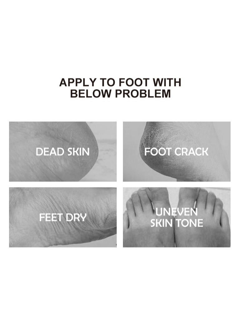 Kormesic 5PCS Lavender Foot Mask 35ml/pair - Image 4