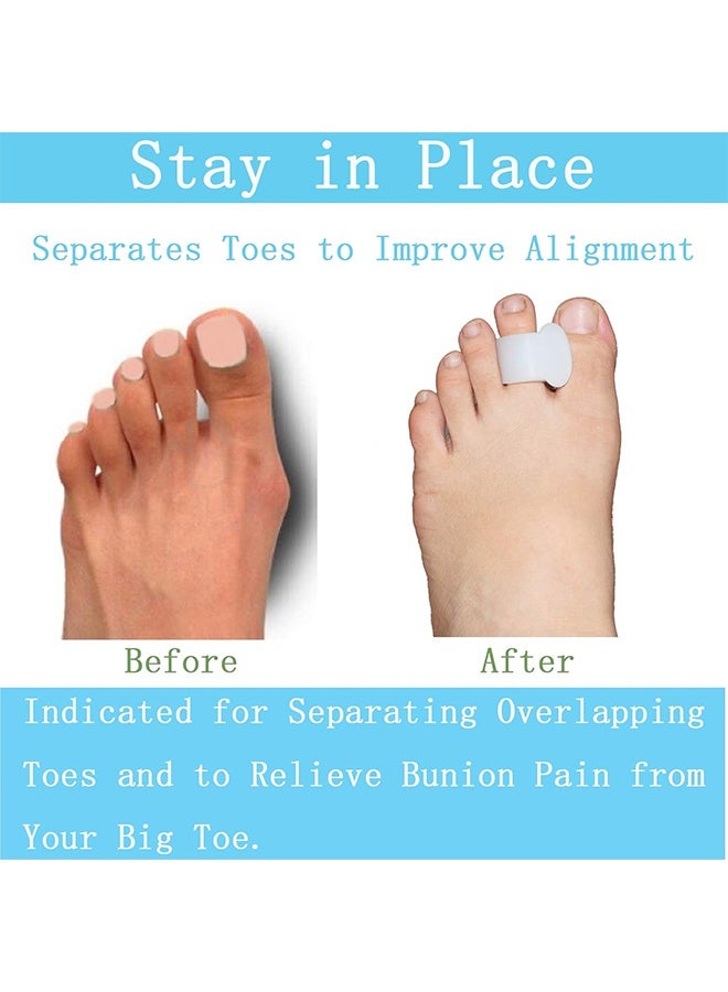 6PCS Single-Loop Toe Separators - Correcting Bunions and Restoring Toes to Their Original Shape - For Men and Women - Toe Spacers Bunion Corrector - White - Image 5