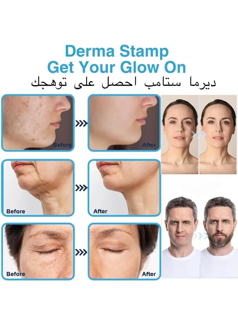 قلم ديرما رولر بإبر دقيقة قابلة للتعديل للوجه والجسم ونمو الشعر، أداة عناية بالبشرة قابلة لإعادة الاستخدام مع غطاء واقٍ للإبر، يُحسّن ملمس البشرة ويعزز امتصاص المنتجات لبشرة أكثر نعومة وإشراقًا - Image 3