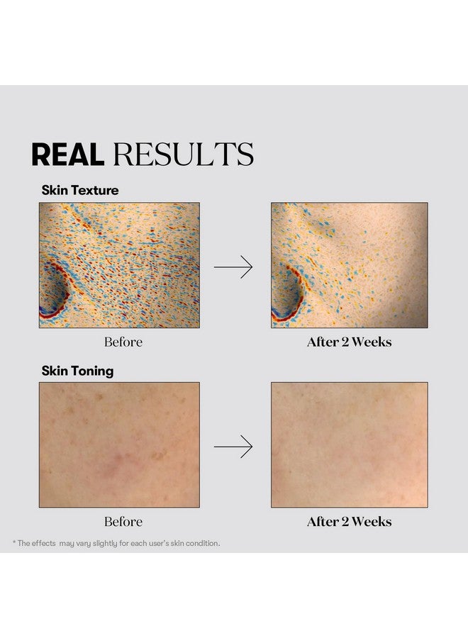VT COSMETICS VT COSMETICS TX Toning Essence 1000 Shot, Tranexamic Acid Serum with Niacinamide, Glutathione for Radiant Glass Skin Face, Dark Spots, Acne Scar, Sensitive Skin Care, Korean Skincare, Fragrance-Free - Image 4