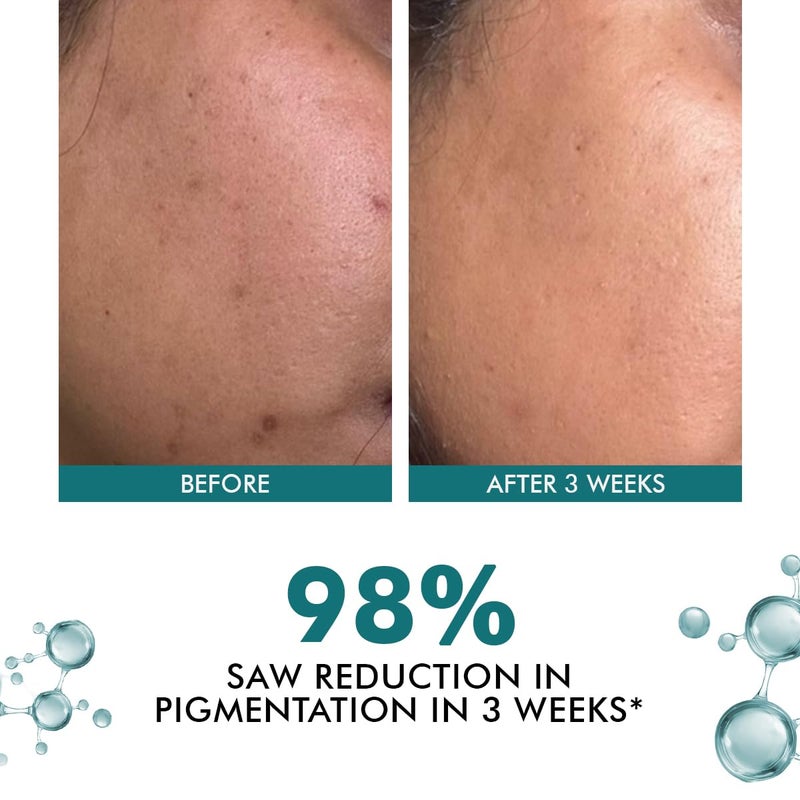 Conscious Chemist Kojic Acid Face Cream 20g Azelaic Acid Cream Face Cream for Men Women Niacinamide Tranexamic Acid Anti Pigmentation Cream Reduce Dark Spots All Skin Type Trubiom Pack of 2 - Image 5