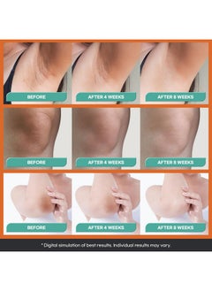 Natural Vine Natural Vine Dark Spot Corrector: Dark Spot Remover for Face Body in 4-8 Weeks - Instant Concealing & Age Brown Sun Faded Spot Remover Melasma Freckles Correcting with Niacinamide for Women & Men 60g  - Image 5