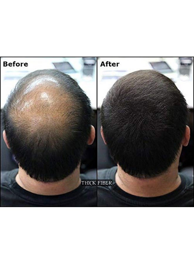 THICK FIBER Hair Fibers for Thinning Hair & Bald spots (BLACK) - 25g Bottle - Conceals Hair Loss in Seconds - Hair Powder for Women & Men - Image 5