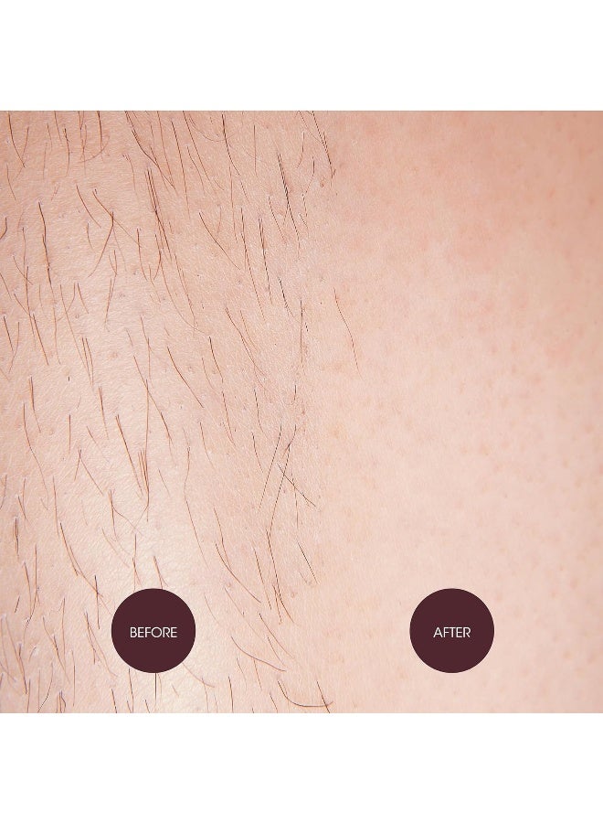Nad's Brazilian & Bikini Wax - Image 5