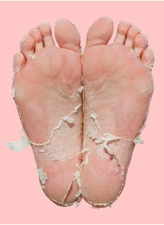 SKIN REPUBLIC Skin Republic Pedi Foot Peel Max 15% stronger acids removes severely dry skin and cracked heels after 7 days, fights foot odour (1 pair) 40ml  - Image 4