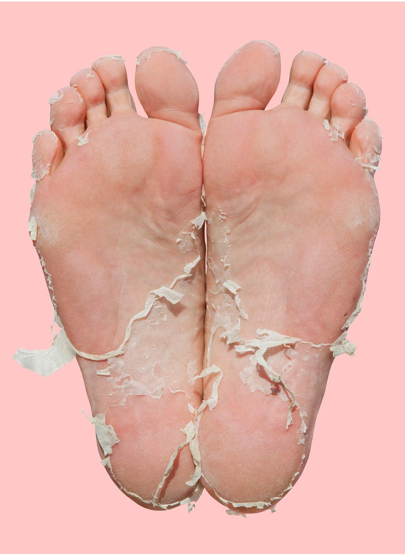 SKIN REPUBLIC Skin Republic Pedi Foot Peel Max 15% stronger acids removes severely dry skin and cracked heels after 7 days, fights foot odour (1 pair) 40ml  - Image 4