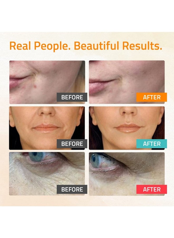 YEOUTH Retinol Serum for Face - Vitamin C Serum for Face with Hyaluronic Acid Serum for Face - Retinol for Face Serum - Vitamin C Face Serum for Women - Skin Care Set 3x1 oz- Serum Set for Face - Image 3