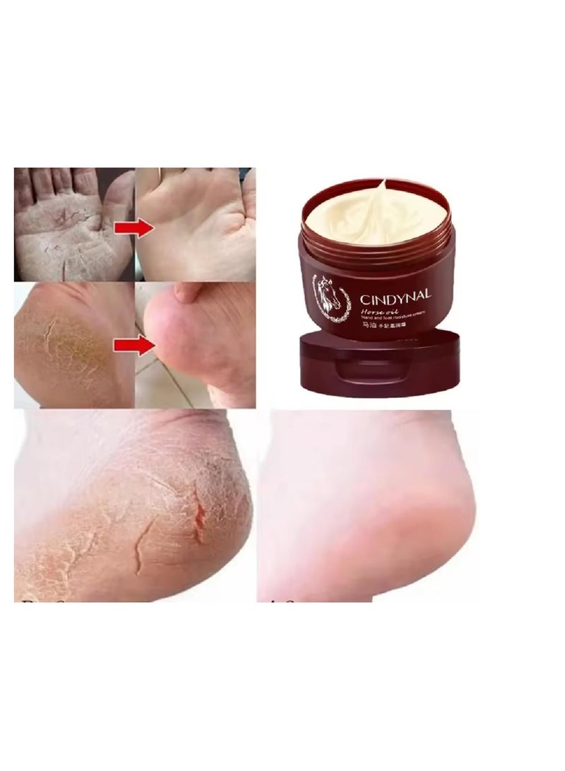 Cindynal Anti-Fungal Foot and Hand Repair Cream Ultimate Solution Healthy Feet Dead Skin Removal Peeling Moisturizing Exfoliation Foot Care Repair For Cracked Heels Natural Organic Moisturizer Horse Oil Repair Moisturizing Hand Cream, Preventing Your Skin from Peeling & Cracking, Making Your Hands and Feet Smooth & Soft  - Image 5