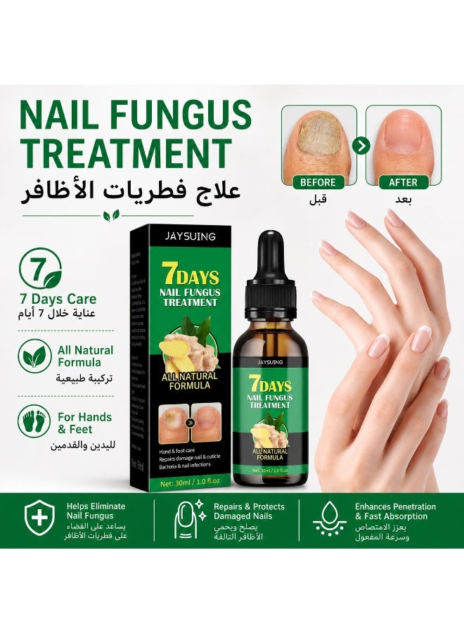 7 Days Nail Fungus Treatment 30Ml Ginger Nail Repair Serum Cuticle Care Oil For Damaged Nails Nail Strengthener For Hand And Foot Care