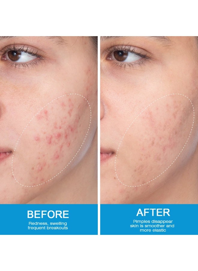 Sumifun Herbal Plant Cleansing Cream for Skin External Use 20g - Image 5