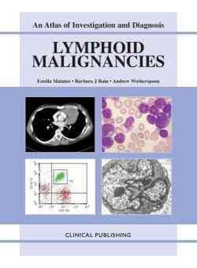 Lymphoid Malignancies