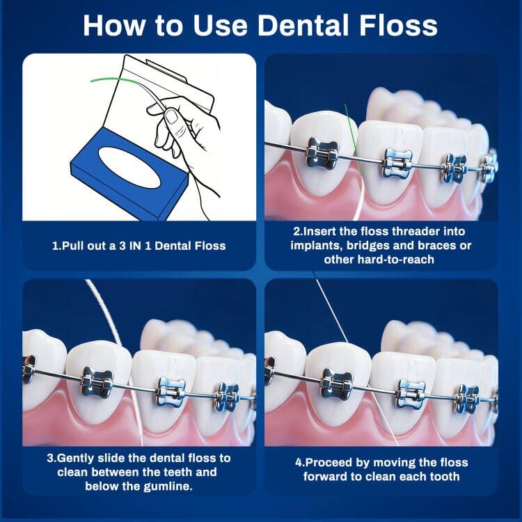 Houselog 3-in-1 Dental Floss with Threaders for Braces,Bridges,and Crowns - 160 Count Pre-Cut Strands - Spongy Floss Middle & Regular Tail for Orthodontic Oral Care - Image 3
