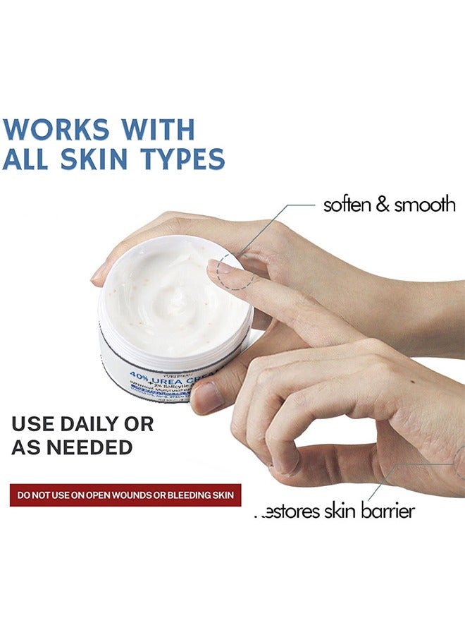 YURHERSU كريم اليوريا 40٪ بالإضافة إلى حمض الساليسيليك 1.76 أوقية ، كريم الكالس مزيل اليدين كريم القدم للأقدام الجافة المتشققة واليدين والمرفقين والركبتين ، يرطب وينعم البشرة بشكل مكثف ويقشر الجلد الميت - Image 5