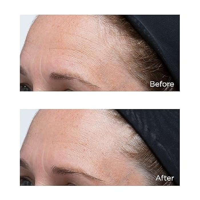 Perricone MD High Potency Classics: Hyaluronic Intensive Moisturizer 1 Fl Oz (Pack of 1) - Image 4