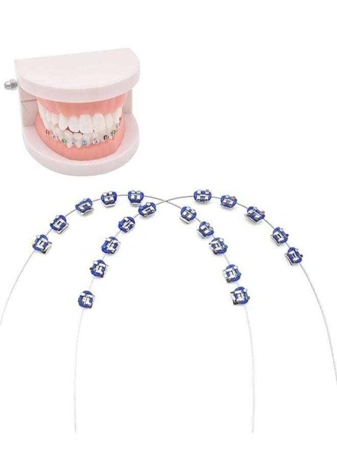 Temporary Tooth Decoration Blue Metal Wires Brackets Orthodontic Ligature Ties Dental Training Practice Props For Dental Students Teaching Learning Supplies Blue - Image 1