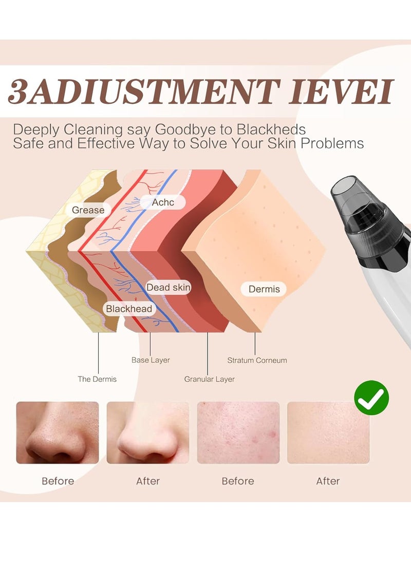 General Multifunctional Blackhead Remover Pore Vacuum Heating, Electric Acne Blackhead Remover Tool, 4 Types of Suction Power with LED Display, Rechargeable Acne Remover Tool Kit  - Image 2