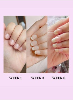 Joviality Strong N' Long Nourishing Nail & Cuticle Oil - pzsku/Z7DAAC08B6611FF79D149Z/45/_/1723815854/ffa7c586-ccd5-4aa7-82bc-7f079de4d0f4