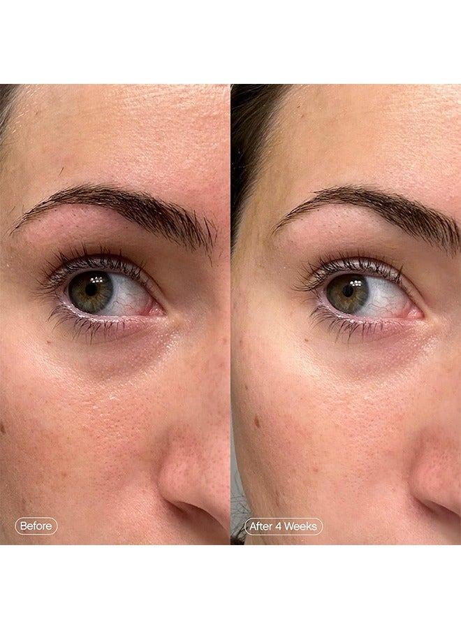 TOPICALS Brightening & Clearing Eye Masks - Faded Brightening Under Eye Masks | Revitalizing Patches to Depuff, Hydrate, and Illuminate | Diminishes Dark Circles and Fine Lines | Made with Kojic Acid, Caffeine & Niacinamide - Image 5