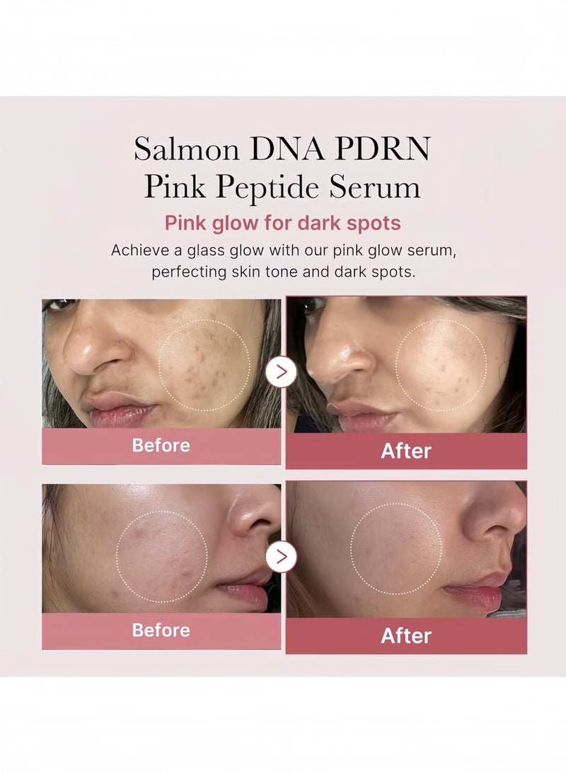 ميديكيوب مصل الببتيد الوردي بDNA السلمون PDRN، مصب توهج وردي، ببتيد، نياسيناميد، مرطب ومنعم ومقوي، لون البشرة غير المتكافئ، العناية الكورية بالبشرة | 1.01 أونصة سائلة (1.01 أونصة سائلة، DNA السلمون PDRN) - Image 2