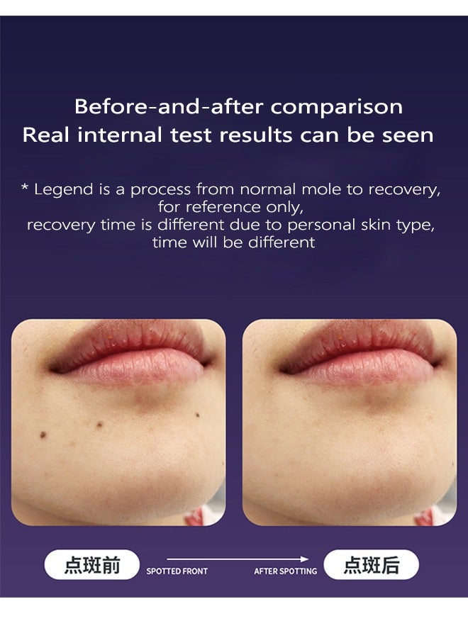 Spot Removal Pen with 9 Modes and LCD Display Replaceable Needle, USB Rechargeable Mole Removal Pen Skin Tag Removal Tool for Wart Spot Tattoo Body Freckles - Image 3