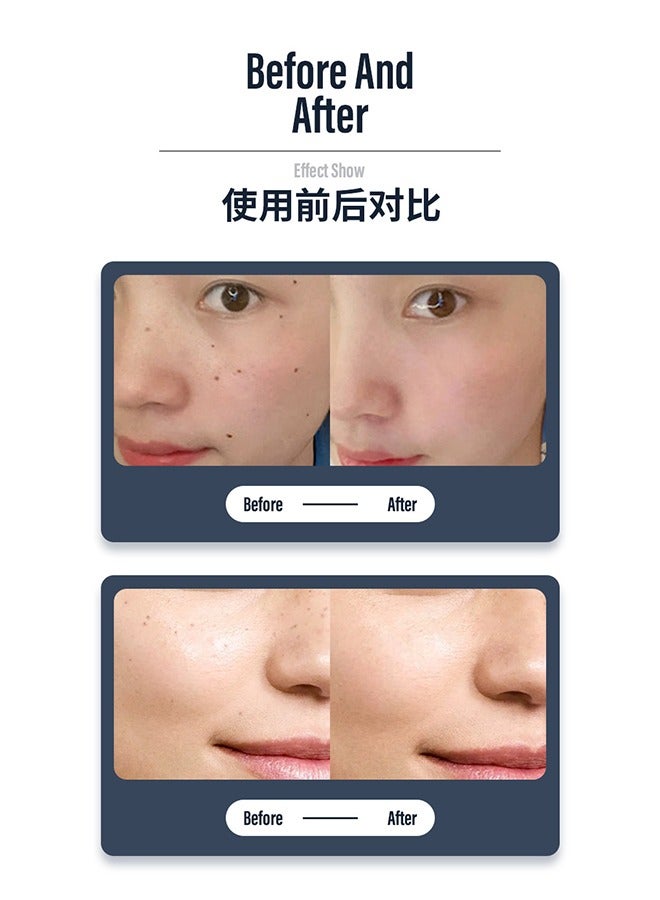 Spot Removal Pen with 9 Modes and LCD Display Replaceable Needle, USB Rechargeable Mole Removal Pen Skin Tag Removal Tool for Wart Spot Tattoo Body Freckles - Image 4