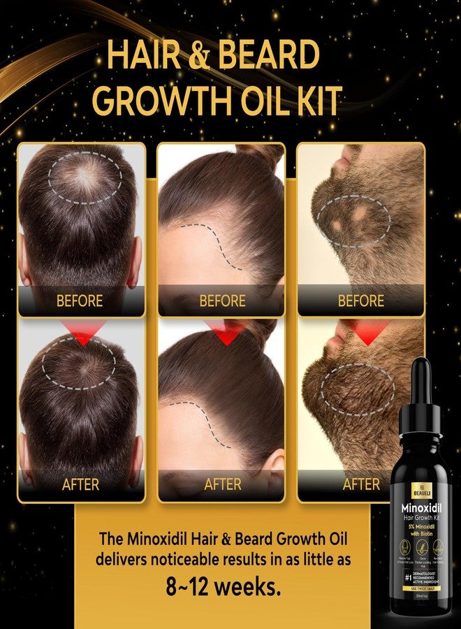 beaueli Minoxidil for Men Beard Growth Kit, Minoxidil for Women Hair Growth Kit, Hair Loss Treatments for Women Hair Regrowth Treatment, Minoxidil 5%, Black - Image 2
