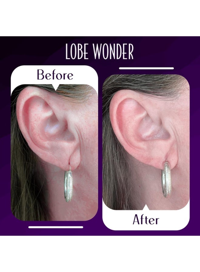 Lobe Wonder - The ORIGINAL Ear Lobe Support Patch for Pierced Ears - Eliminates the Look of Torn or Stretched Piercings - Protects Healthy Ear Lobes from Tearing - 60 Patches - Clear & Latex-Free - Image 5