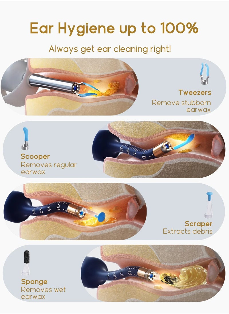 Bebird - Earsight Plus Ear Wax Removal Tool – HD Camera Ear Cleaner with WiFi App, 4-in-1 Cleaning Kit (Spade/Spoon/Picker/Tweezers), Soft Silicone Tips, Rechargeable & Wireless for Safe, Visual Ear Cleaning – Dark Blue - Image 1