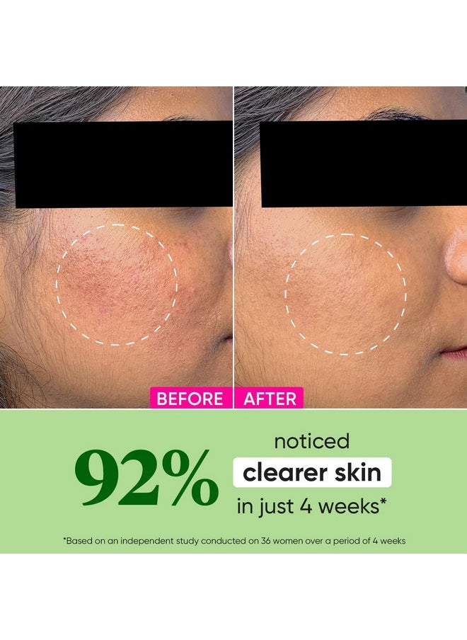 Dot & Key - Cica + Niacinamide Oil Free Moisturizer For Acne Prone Skin Oil Free & Lightweight Fades Dark Spots & Blemishes, Soothes Redness Acne Cream For Oily Acne Prone & Sensitive Skin 50Gm - Image 1