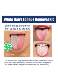 Jaysuing White hair tongue removal kit, tongue scraper cleaning kit, tongue cleaning gel with cleaning brush to freshen breath  - Image 2