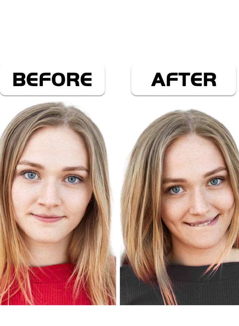 RTYY قطعتان من أداة صنع الغمازات، أداة تدريب الغمازات على الوجه، سهلة الارتداء وتطوير الغمازات الطبيعية للحصول على ابتسامة جميلة - Image 3