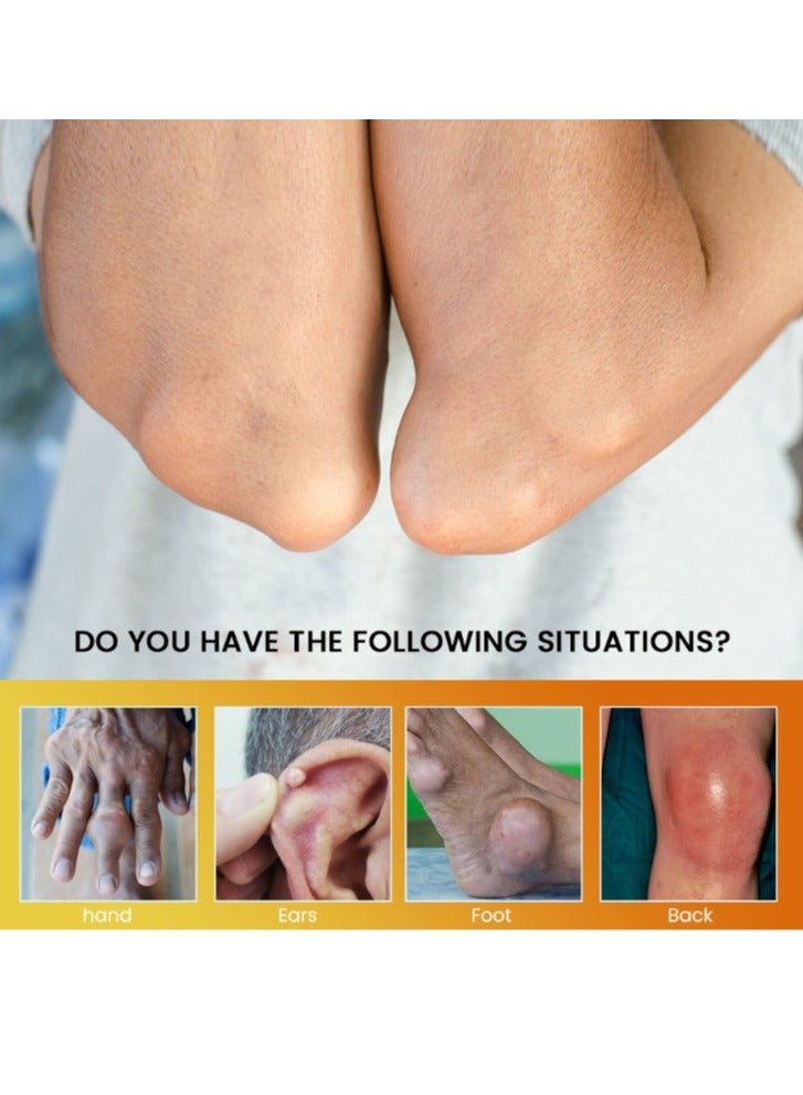 Sumifun 20g Gout Cream Treat Bunion Hallux Valgus Corrector Pain Relief Ointment Foot Toe Swelling Ache Plaster  - Image 2