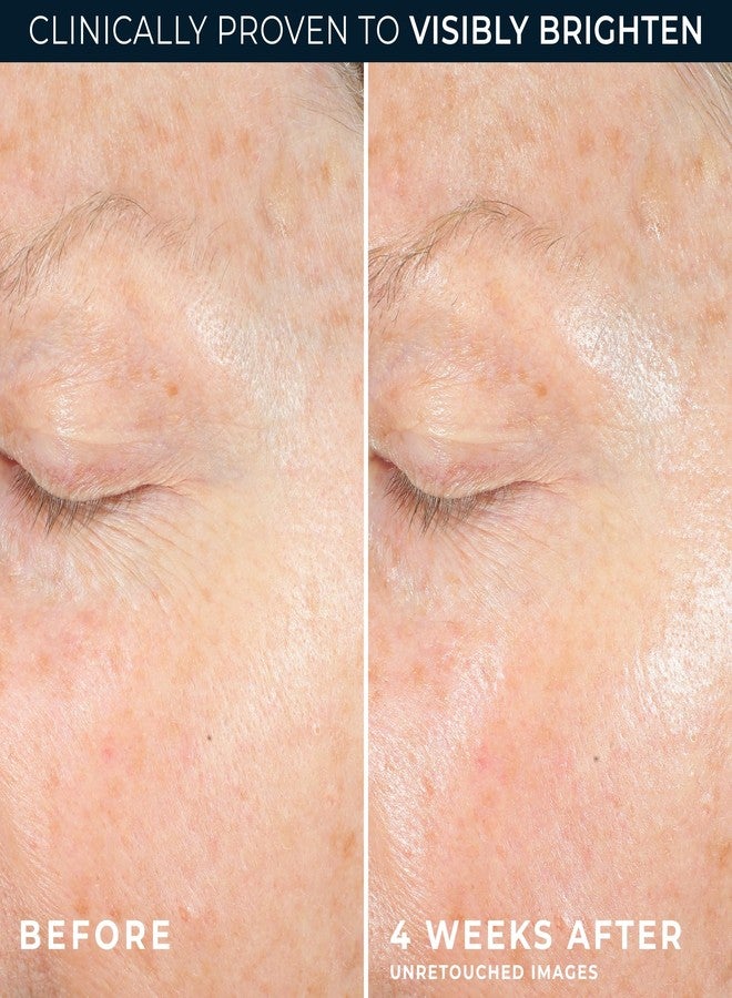 RoC مرطب وجه روك متعدد التصحيح ريفيف + جلو 10% مزيج فيتامين سي، كريم جل مضاد للشيخوخة للحصول على إشراقة فورية، خالي من الزيوت ومضاد للحساسية، 1.7 أونصة (قد يختلف التعبئة) - Image 5